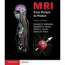 MRI from Picture to Proton