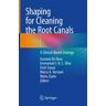 Shaping for Cleaning the Root Canals