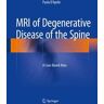 MRI of Degenerative Disease of the Spine