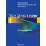 Male Genital Lesions