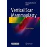 Vertical Scar Mammaplasty