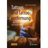 Tattoos und Tattooentfernung