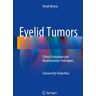 Eyelid Tumors