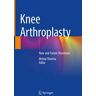 Knee Arthroplasty