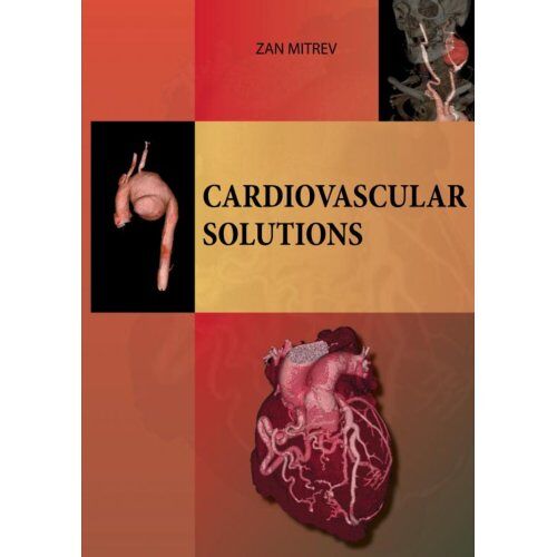 Mijnbestseller B.V. Cardiovascular Solutions - Zan Mitrev