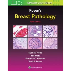 Rosen'S Breast Pathology Av Syed A. Hoda, Paul Peter Md Rosen, Edi Brogi, Frederick C. Koerner