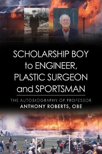 Troubador Publishing Scholarship Boy To Engineer, Plastic Surgeon And Sportsman: (The Memoirs Of Professor Anthony Roberts Obe)