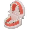 Tyenaza Orthodontisch tandenmodel, Typodonts Orthodontie demonstratiemodel met metalen draden en beugel Onderwijs-, leer-, interpretatiemodel voor volwassenen en kinderen