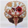 FLYIFE Medische modellen, medisch menselijk brein anatomisch model, menselijk hersenziekte model, hersenpathologieën hersenstam hersenbloeding studie anatomie model