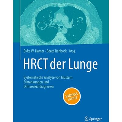 Springer Berlin HRCT der Lunge Springer Berlin HRCT der Lunge
