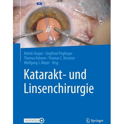 Springer Berlin Katarakt- und Linsenchirurgie Springer Berlin Katarakt- und Linsenchirurgie