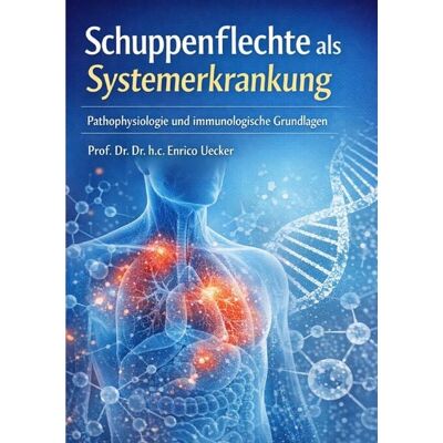 Epubli „Schuppenflechte als Systemerkrankung - Pathophysiologie und immunologische Grundlagen“ Epubli „Schuppenflechte als Systemerkrankung - Pathophysiologie und immunologische Grundlagen“