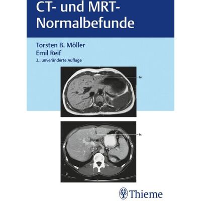 Thieme CT und MRT Normalbefunde Thieme CT und MRT Normalbefunde
