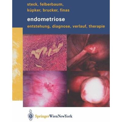Springer Vienna Endometriose Springer Vienna Endometriose
