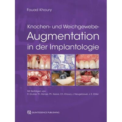 Quintessenz Verlag Knochen- und Weichgewebeaugmentation in der Implantologie Quintessenz Verlag Knochen- und Weichgewebeaugmentation in der Implantologie
