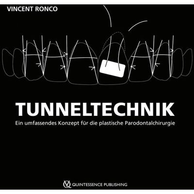 Quintessenz Verlag Tunneltechnik Quintessenz Verlag Tunneltechnik