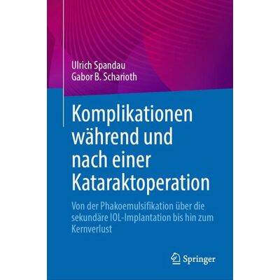 Springer Komplikationen während und nach einer Kataraktoperation Springer Komplikationen während und nach einer Kataraktoperation