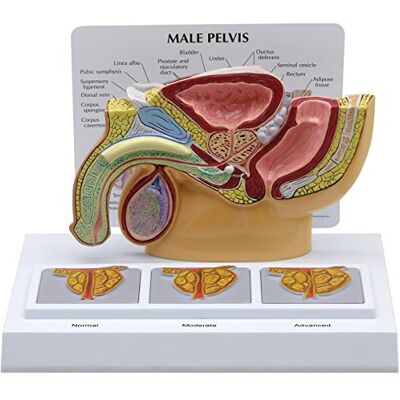3B Scientific GPI Anatomicals 3551 Becken männlich Modell mit Prostata, 3D 3B Scientific GPI Anatomicals 3551 Becken männlich Modell mit Prostata, 3D