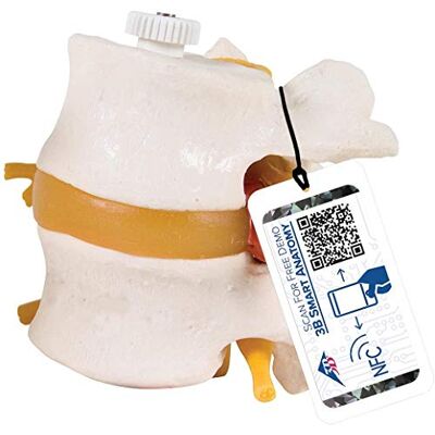 3B Scientific Menschliche Anatomie 2 Lendenwirbel mit Bandscheibenvorfall, elastisch montiert + kostenlose Anatomie App 3B Smart Anatomy 3B Scientific Menschliche Anatomie 2 Lendenwirbel mit Bandscheibenvorfall, elastisch montiert + kostenlose Anatomie App 3B Smart Anatomy