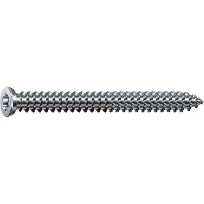Spax, Schrauben, Spax-Ra Flachsenkkopf T-Star Plus T30 Vollgewinde Wirox (100 Schrauben pro Stück, 7.5 x 100 mm) Spax, Schrauben, Spax-Ra Flachsenkkopf T-Star Plus T30 Vollgewinde Wirox (100 Schrauben pro Stück, 7.5 x 100 mm)