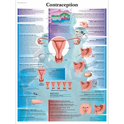 3B Scientific VR2591L Planche Anatomique, Contraception 3B Scientific VR2591L Planche Anatomique, Contraception