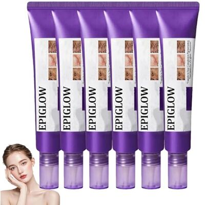 JIAOY EPIGLOW Advanced Lot de 6 crèmes pigmentaires hydratantes pour correction du tonus, traitement pigmentaire, anti-âge, élimination des taches brunes, de la peau JIAOY EPIGLOW Advanced Lot de 6 crèmes pigmentaires hydratantes pour correction du tonus, traitement pigmentaire, anti-âge, élimination des taches brunes, de la peau