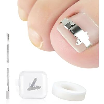 Ferizzia Lot de 3 outils correcteurs pour ongles incarnés, pour le traitement de la paronychie Ferizzia Lot de 3 outils correcteurs pour ongles incarnés, pour le traitement de la paronychie