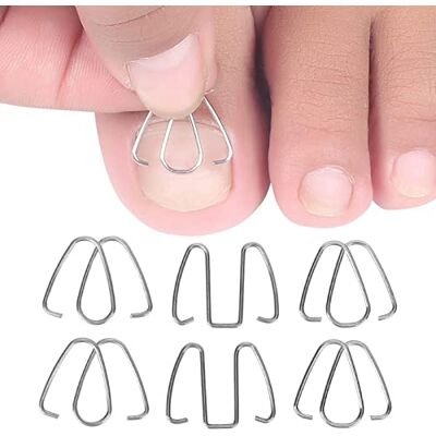 YUYTE Fil correcteur d'ongle d'orteil, outil correcteur d'ongle d'orteil, redressement de fil de traitement de pédicure outil de soin des pieds pour réparation des ongles soins des pieds, correcteur YUYTE Fil correcteur d'ongle d'orteil, outil correcteur d'ongle d'orteil, redressement de fil de traitement de pédicure outil de soin des pieds pour réparation des ongles soins des pieds, correcteur