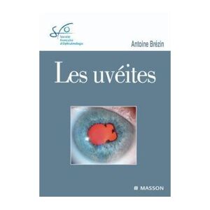 Elsevier Masson Les uvéites - Antoine Pierre Brézin - cartonné
