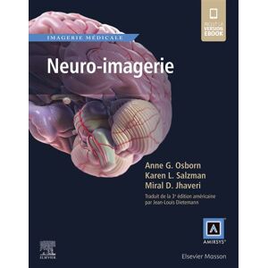 Elsevier Masson Neuro-imagerie - Karen L. Salzman - broché