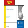 Elsevier Masson Hallux valgus - Docteur Barbara Piclet-Legré - relié