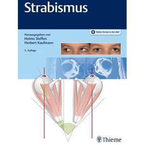 Thieme Strabismus Thieme Strabismus