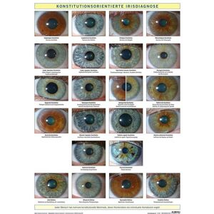 Bacopa Konstitutionsorientierte Irisdiagnose Bacopa Konstitutionsorientierte Irisdiagnose