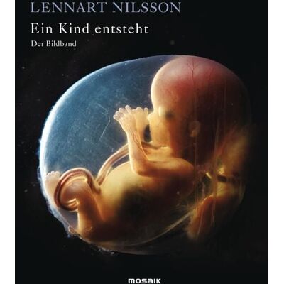 Mosaik Ein Kind entsteht - Der Bildband Mosaik Ein Kind entsteht - Der Bildband