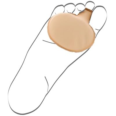 Berkemann Unisex Vorfußpolster Einlegesohlen, Beige, Medium EU Berkemann Unisex Vorfußpolster Einlegesohlen, Beige, Medium EU