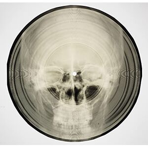 Stephen Coates - Bone Music: Soviet X-Ray Audio - Preis vom 16.06.2026 05:30:18 h Stephen Coates - Bone Music: Soviet X-Ray Audio - Preis vom 16.06.2026 05:30:18 h