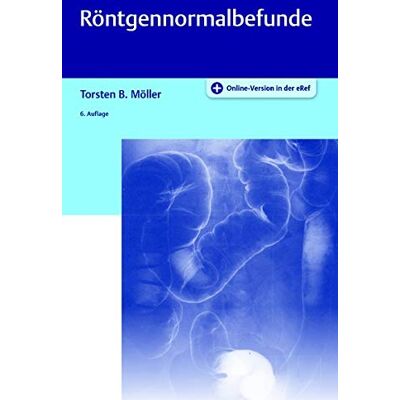Möller, Torsten Bert - Röntgennormalbefunde - Preis vom 20.06.2026 05:23:55 h Möller, Torsten Bert - Röntgennormalbefunde - Preis vom 20.06.2026 05:23:55 h