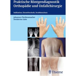 Johannes Flechtenmacher - Praktische Röntgendiagnostik Orthopädie und Unfallchirurgie: Indikation, Einstelltechnik, Strahlenschutz - Preis vom 15.06.2026 05:30:30 h Johannes Flechtenmacher - Praktische Röntgendiagnostik Orthopädie und Unfallchirurgie: Indikation, Einstelltechnik, Strahlenschutz - Preis vom 15.06.2026 05:30:30 h