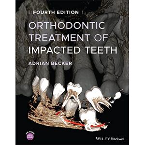 Becker Orthodontic Treatment of Impacted Teeth - Preis vom 13.06.2026 05:28:29 h Becker Orthodontic Treatment of Impacted Teeth - Preis vom 13.06.2026 05:28:29 h