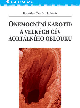 Grada Onemocnění karotid a velkých cév aortálního oblouku, Čertík Bohuslav