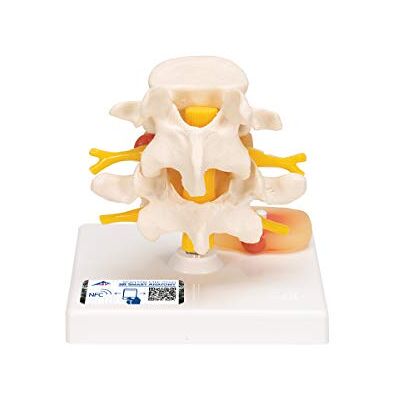 3B Scientific 3B Smart Anatomy bederní páteř s vyhnutím meziobratlových plotének, vč. anatomického softwaru – 3B Smart Anatomy 3B Scientific 3B Smart Anatomy bederní páteř s vyhnutím meziobratlových plotének, vč. anatomického softwaru – 3B Smart Anatomy