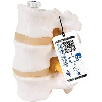 3B Scientific A76/8 3 bederní obratle, flexibilně namontovaný, vč. anatomického softwaru 3B Smart Anatomy 3B Scientific A76/8 3 bederní obratle, flexibilně namontovaný, vč. anatomického softwaru 3B Smart Anatomy