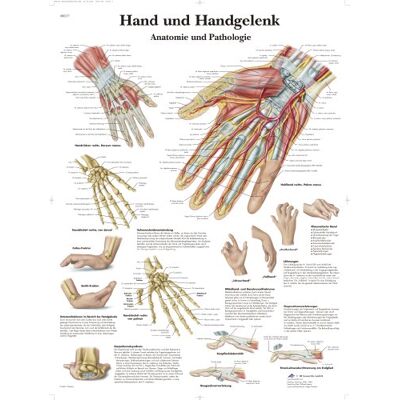 3B Scientific Laminovaná tabule na ruce a zápěstí – anatomie a patologie – plakát odolný proti UV záření a prachu pro studium, výuku a kliniky 3B Scientific Laminovaná tabule na ruce a zápěstí – anatomie a patologie – plakát odolný proti UV záření a prachu pro studium, výuku a kliniky