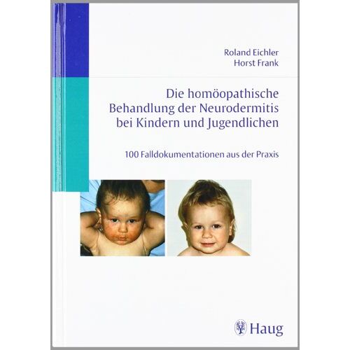 Roland Eichler – GEBRAUCHT Die homöopathische Behandlung der Neurodermitis bei Kindern und Jugendlichen: 100 Falldokumentationen aus der Praxis – Preis vom 08.01.2024 05:55:10 h