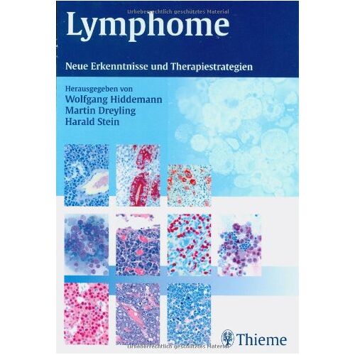 Wolfgang Hiddemann – GEBRAUCHT Lymphome: Neue Erkenntnisse und Therapiestrategien – Preis vom 08.01.2024 05:55:10 h