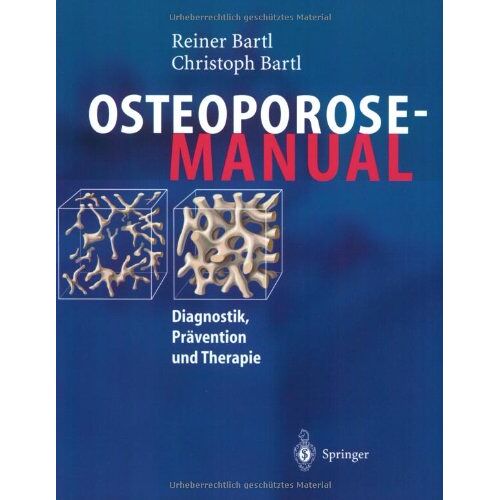 Reiner Bartl – GEBRAUCHT Osteoporose-Manual: Diagnostik, Prävention und Therapie – Preis vom 08.01.2024 05:55:10 h