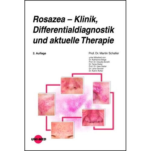 Martin Schaller – GEBRAUCHT Rosazea – Klinik, Differentialdiagnostik und aktuelle Therapie (UNI-MED Science) – Preis vom 08.01.2024 05:55:10 h