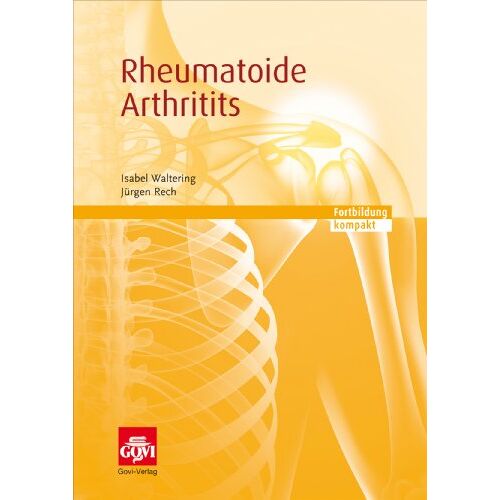 Isabel Waltering – GEBRAUCHT Rheumatoide Arthritis: Fortbildung kompakt – Preis vom 08.01.2024 05:55:10 h