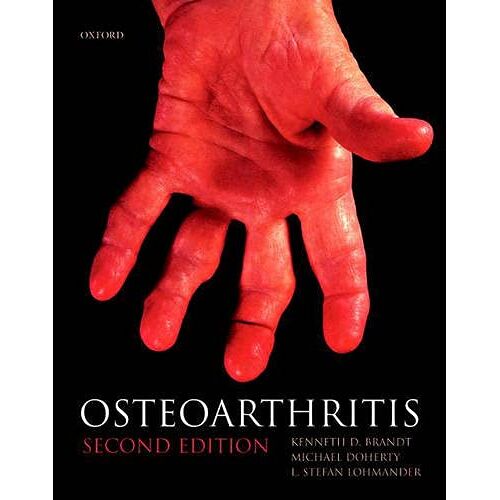 Brandt, Kenneth D. – GEBRAUCHT Osteoarthritis (Oxford Medical Publications) – Preis vom 08.01.2024 05:55:10 h