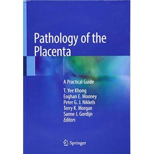 Nikkels, Peter G. J. - GEBRAUCHT Pathology of the Placenta: A Practical Guide - Preis vom 29.04.2024 04:59:55 h